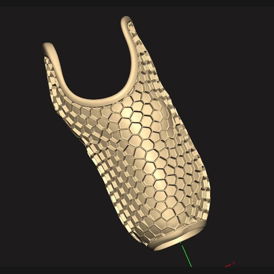 CAD lattice visualization showing advanced digital O&P fabrication
